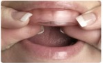 アウタートレーの回りを軽く押し付け、歯全体に  インナートレーの薬剤が絡むようにします。